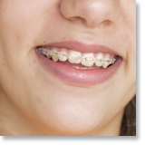 一般歯科　イメージ写真